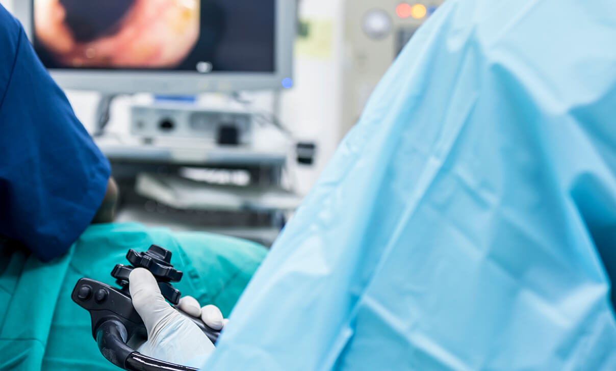 患者の内視鏡検査を行う医師のイメージ